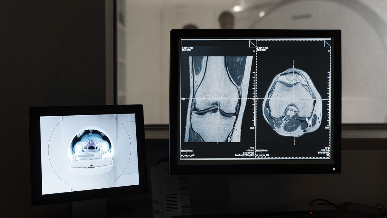 Interventional Radiology