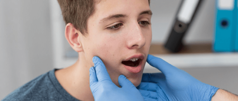 Cleft Palate: 5 Top Treatments for Smiles 4 descargar 65 LIV Hospital