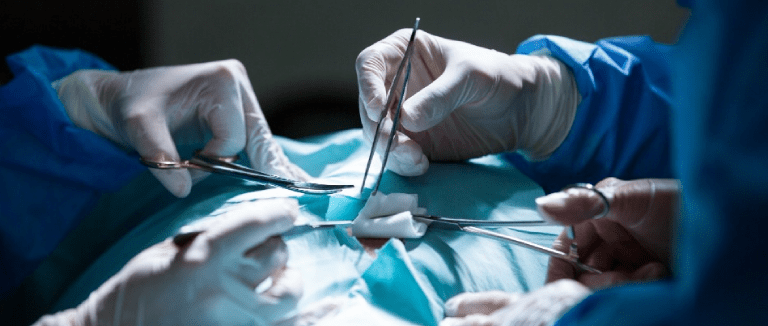 Thoracic surgery