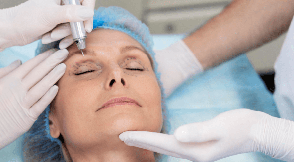 Blepharoplasty in Turkey