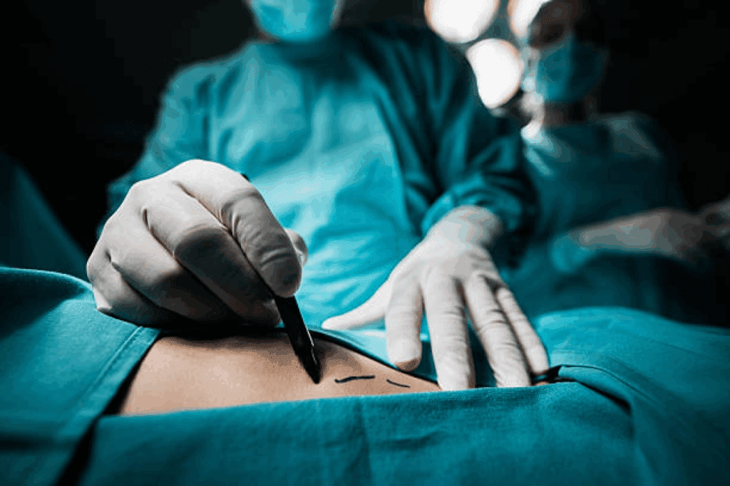 Choosing Between Rny Surgery Vs Sleeve