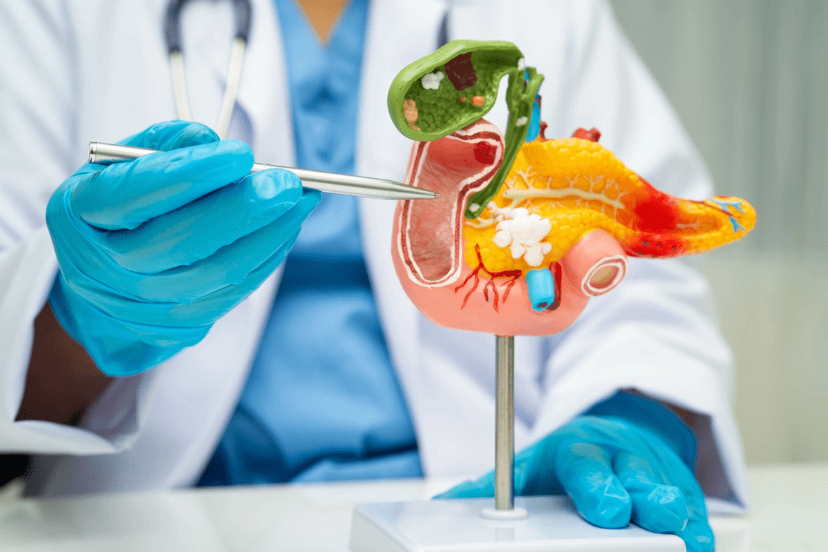 Purpose And Procedure Of Biliary Bypass Operation