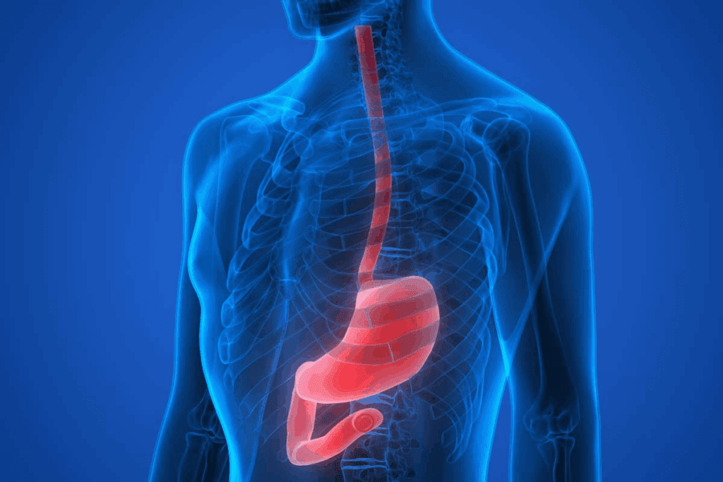 Understanding Schotskys Ring (Schatzki Ring)