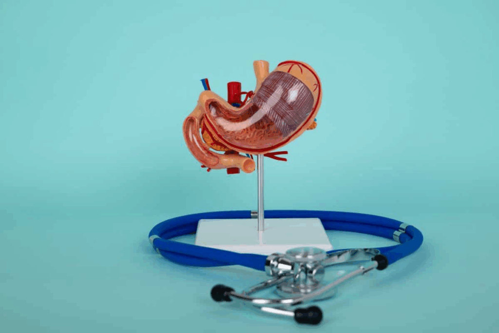 Complete Sleeve Gastrectomy Reviews (Pros & Cons)