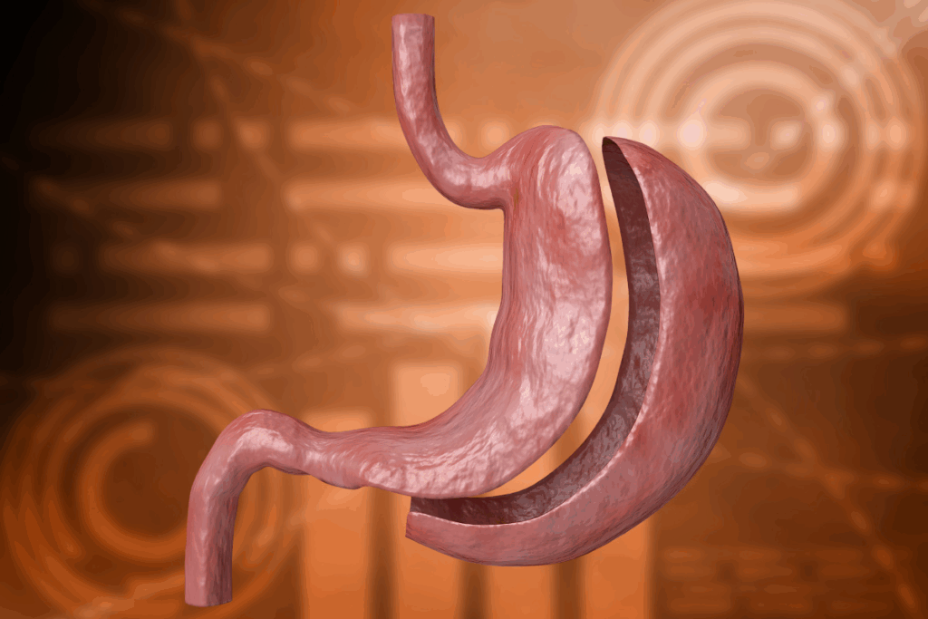 17 Foods What Can You Never Eat Again After Gastric Sleeve