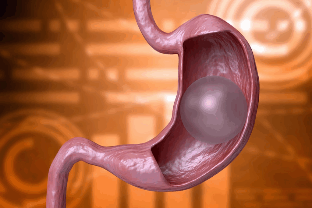 Answer: Bariatric Surgery Requires What Type Of Diet Initially?