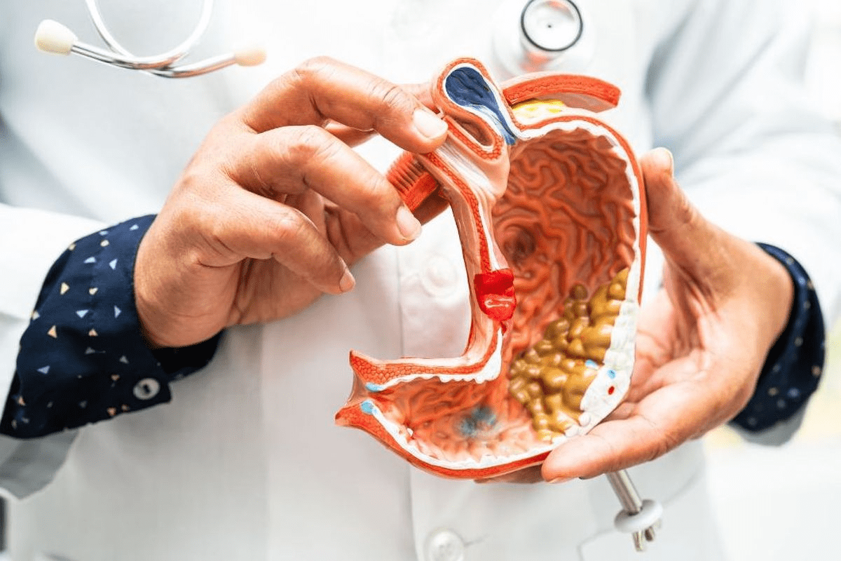 Answer: Bariatric Surgery Requires What Type Of Diet Initially?