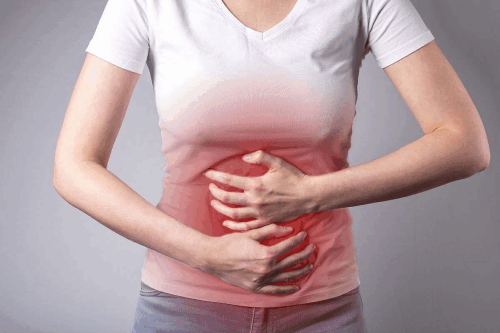 Medical Treatment Of Bowel Obstruction After Gastric Bypass