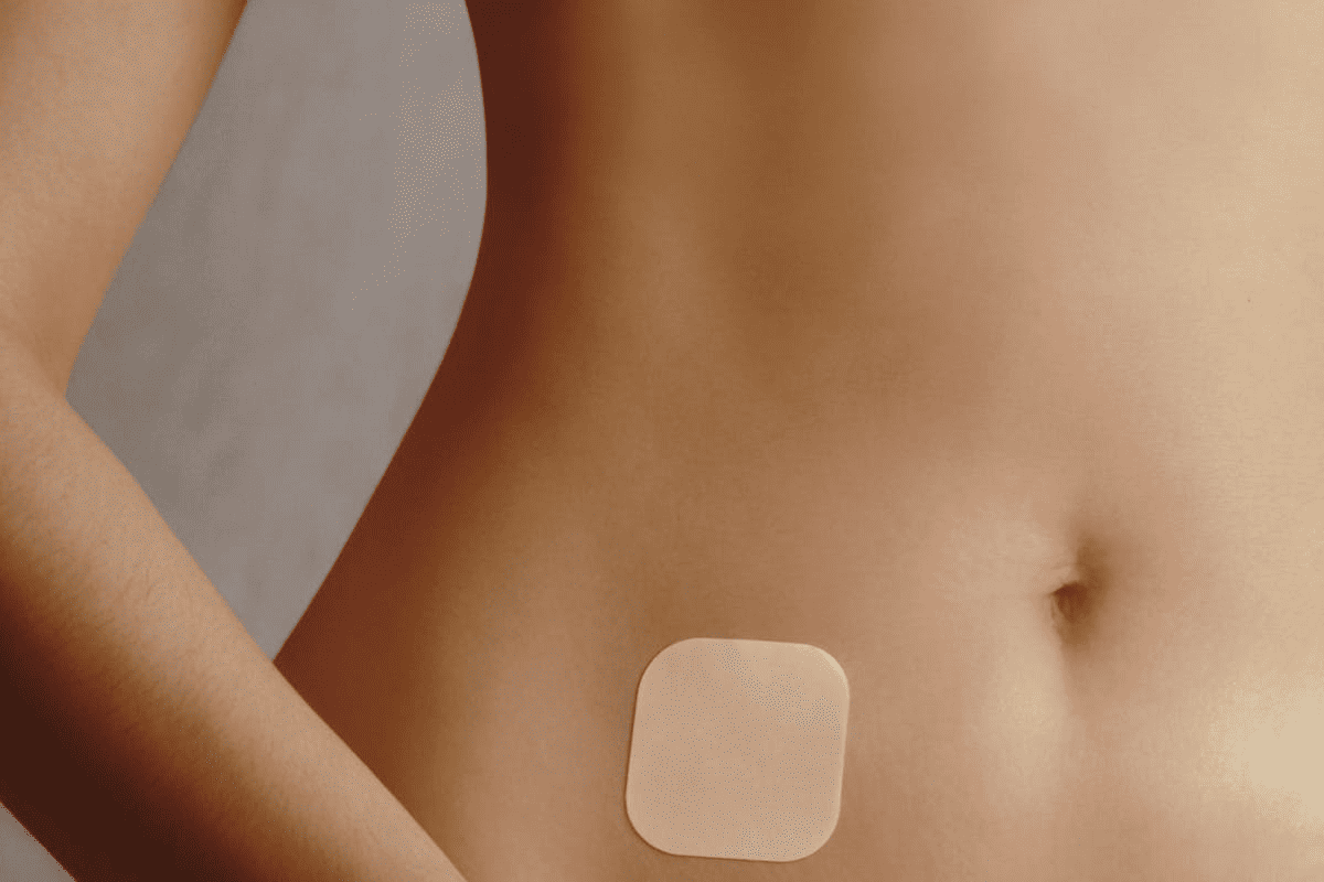 Estrogen Patch and IVF: Your Ultimate Guide