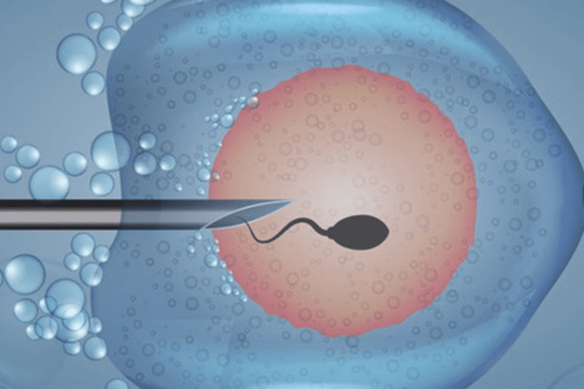 How Fast Do Follicles Grow on Gonal F? Key Facts