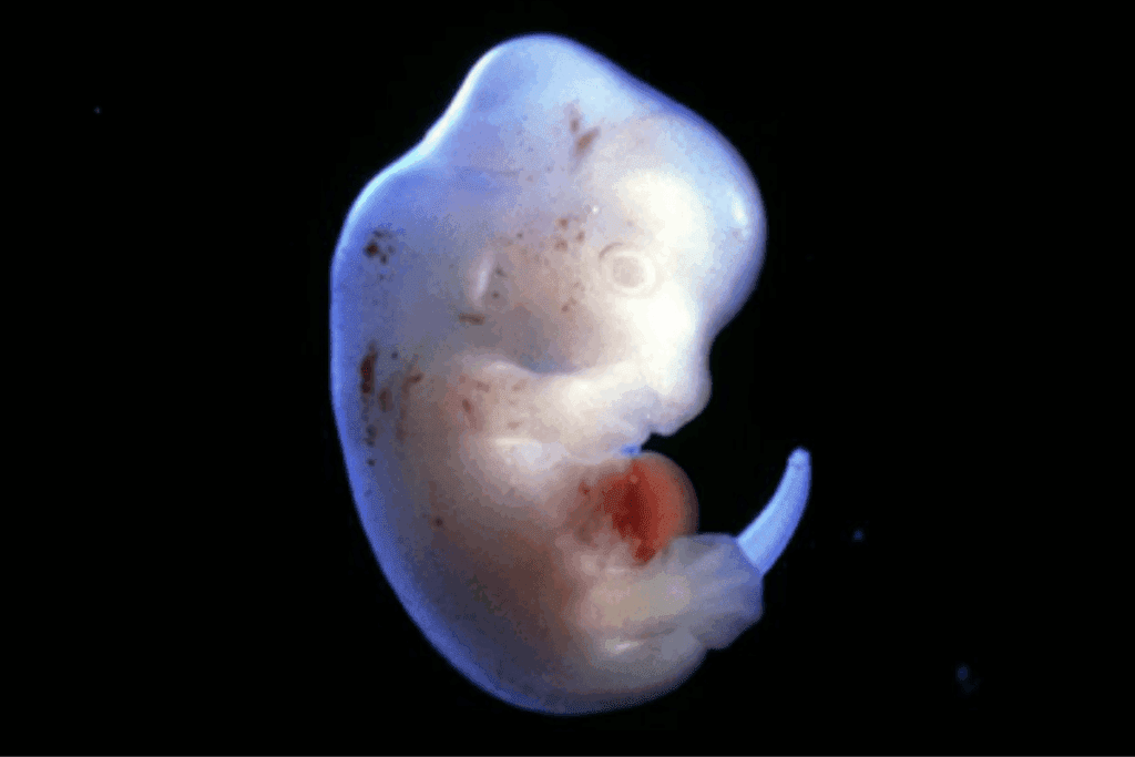 Success Rates and Structure of a 6ba embryo