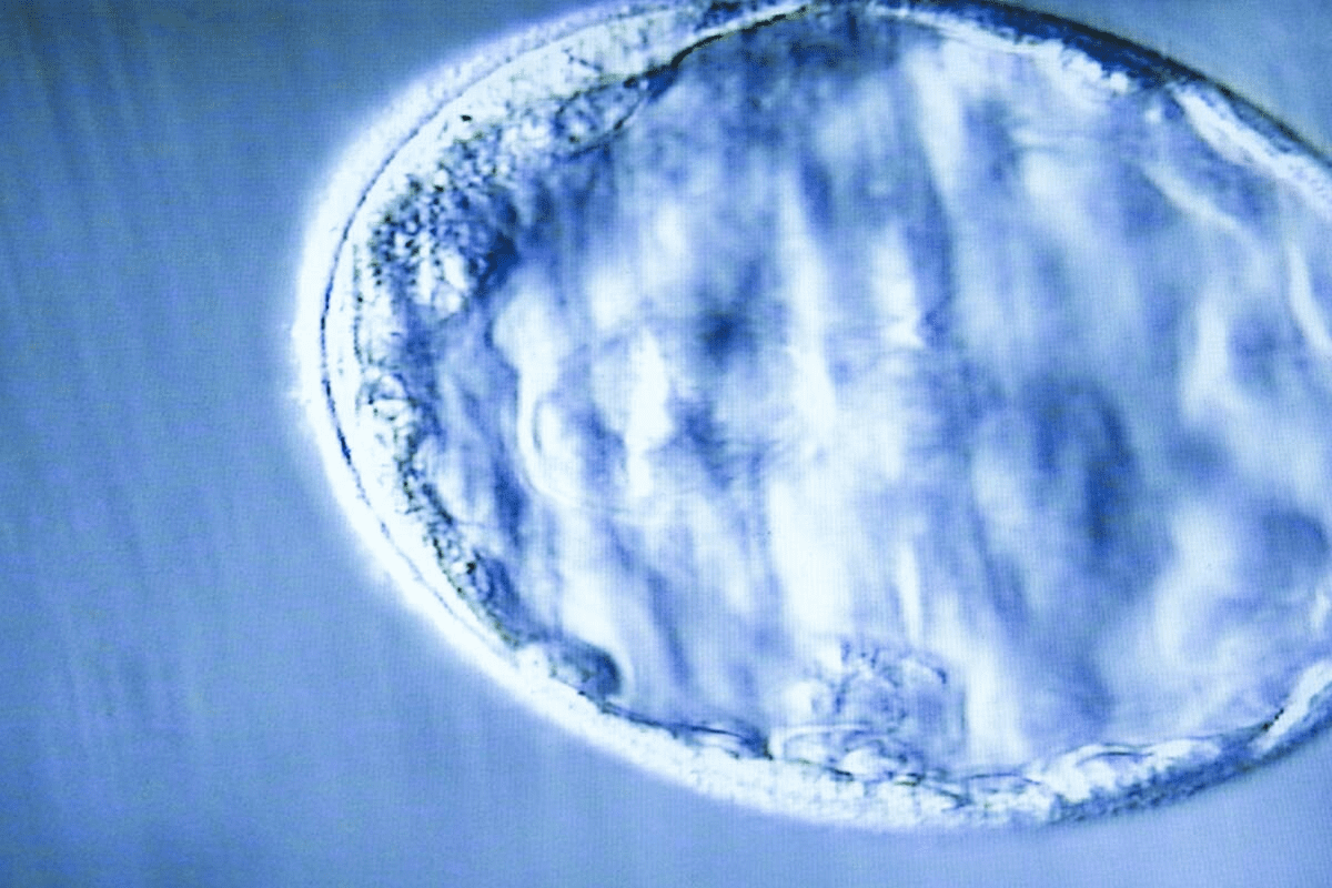 The Success Rate of 5 eggs fertilized with icsi to Blastocyst