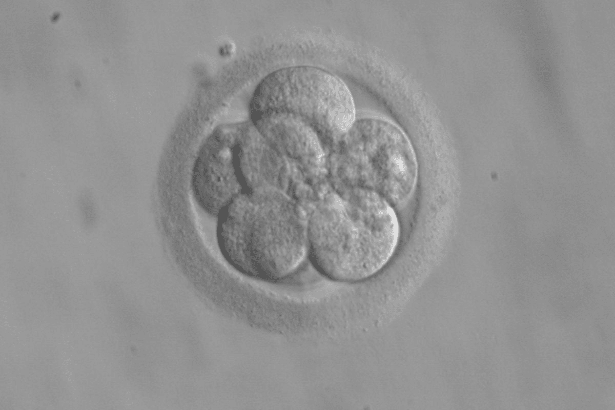 Optimal estradiol levels for egg retrieval (E2 Targets)