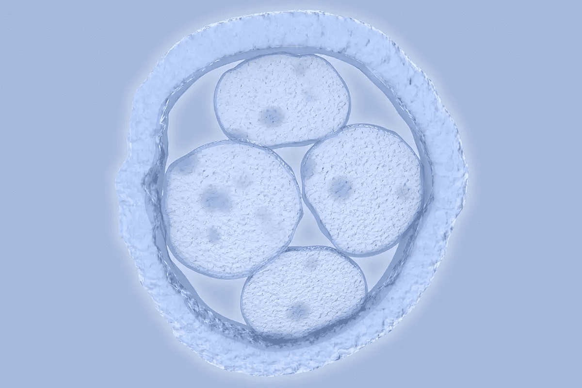 Azoospermia: The condition of without sperm in Ejaculate