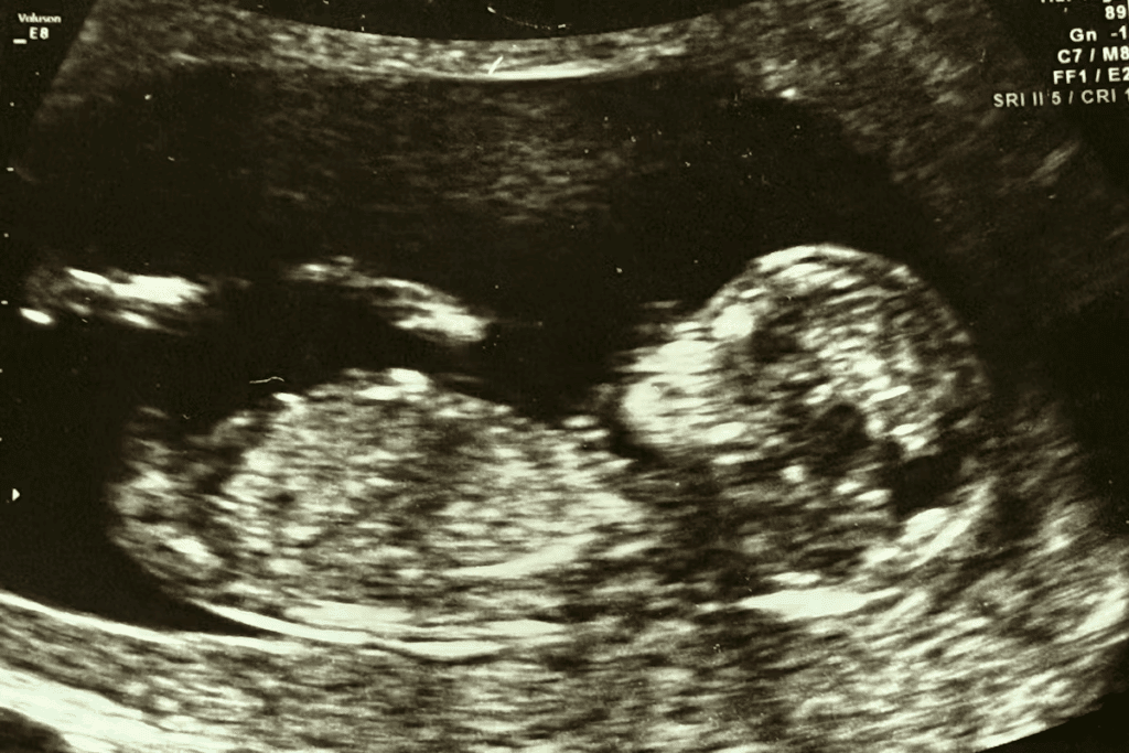 Legal and Ethical Options: does ivf destroy embryos?