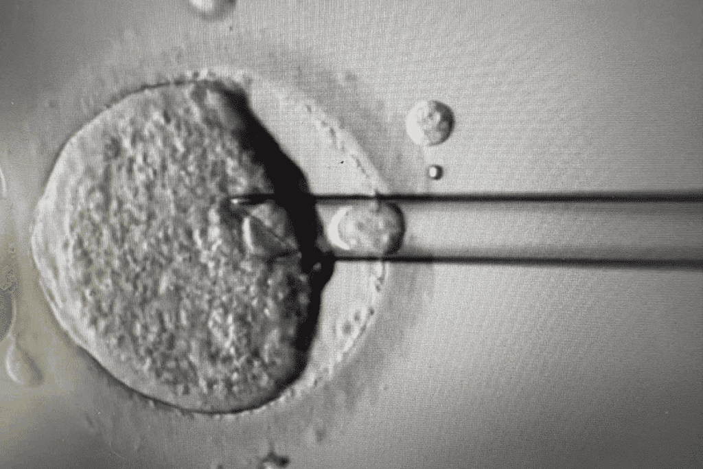Research on: does orgasims help with implantation After Transfer?