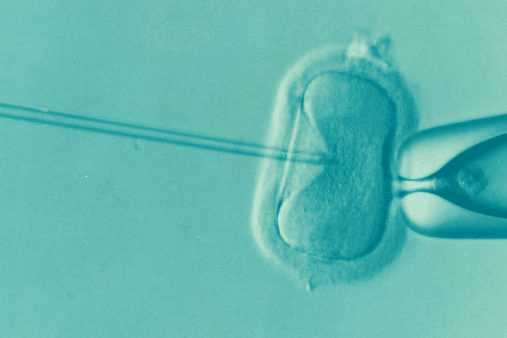 Accurate hcg injection dosage for fertility (Trigger Shot Guide)