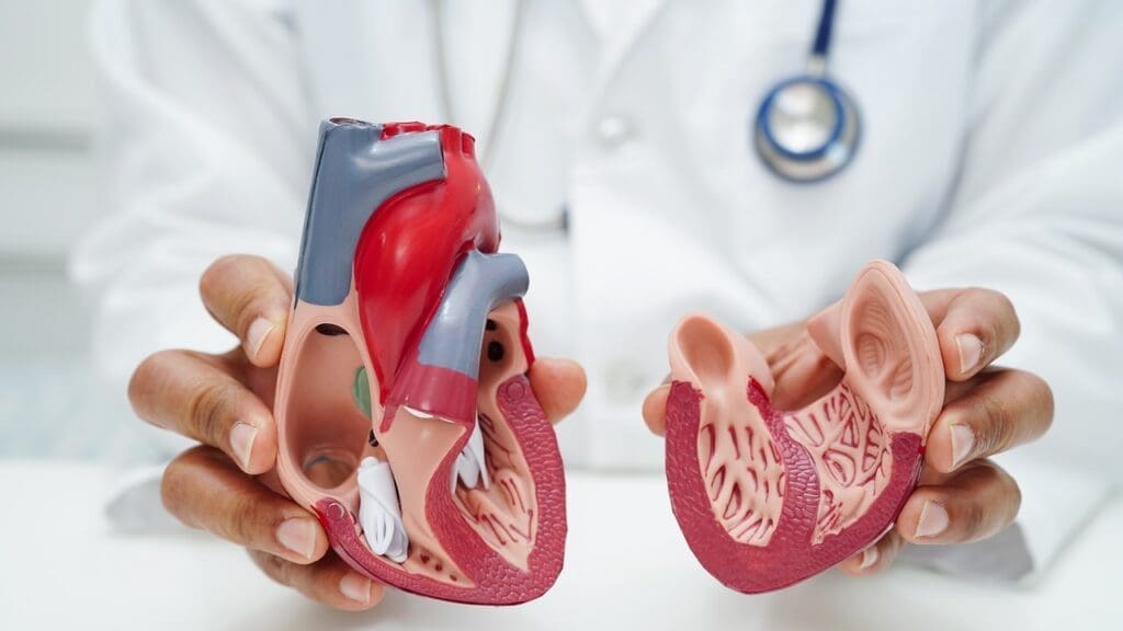 aneurysm of ascending aorta without rupture