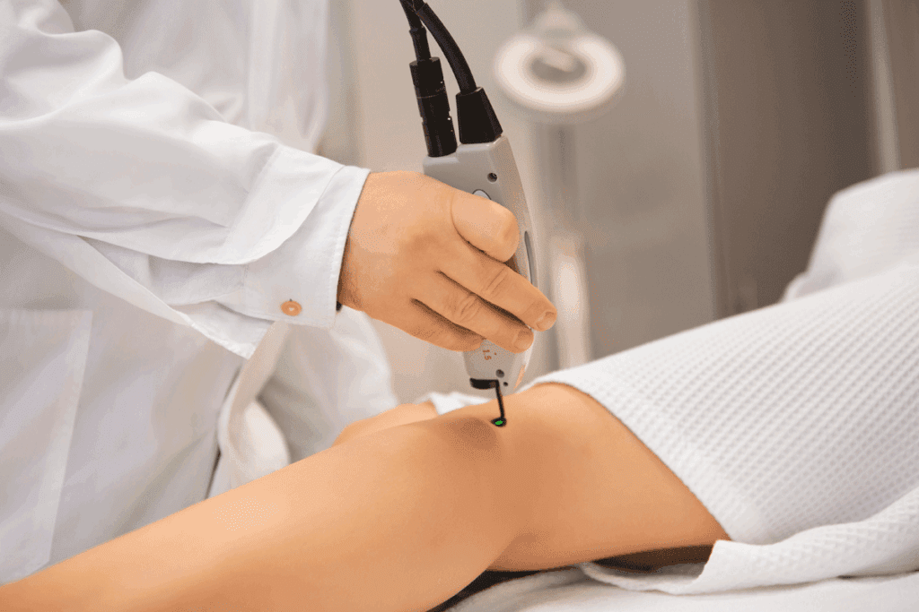 Laser treatment varicose veins procedure: Ultimate Right Guide