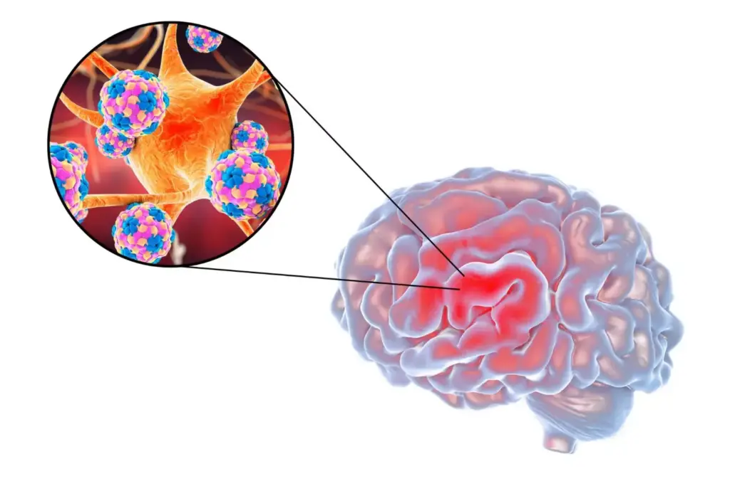 A detailed cross-sectional medical illustration showcasing the impact of a brain tumor on the optic nerve. The foreground depicts a magnified view of the optic nerve, highlighting the swelling and inflammation caused by the tumor's pressure. The middle ground reveals the tumor's location in the brain, casting a menacing shadow over the visual system. The background features a moody, muted palette, conveying the serious nature of the condition. Realistic textures, intricate anatomical details, and a sense of depth create a compelling, educational visual aid. Soft, directional lighting accentuates the pathological changes, while a slightly elevated camera angle provides an informative, comprehensive perspective.