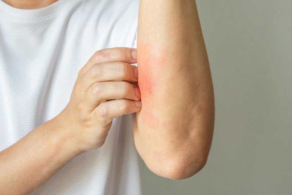 Petechiae Itchy: 8 Common Causes 1 Petechiae Itchy: 8 Common Causes