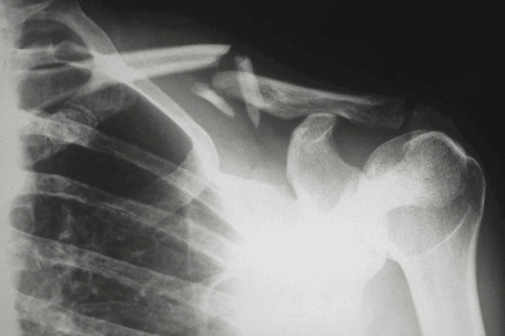 Bone Regeneration Age Limit: The Secret to Lifelong bone health