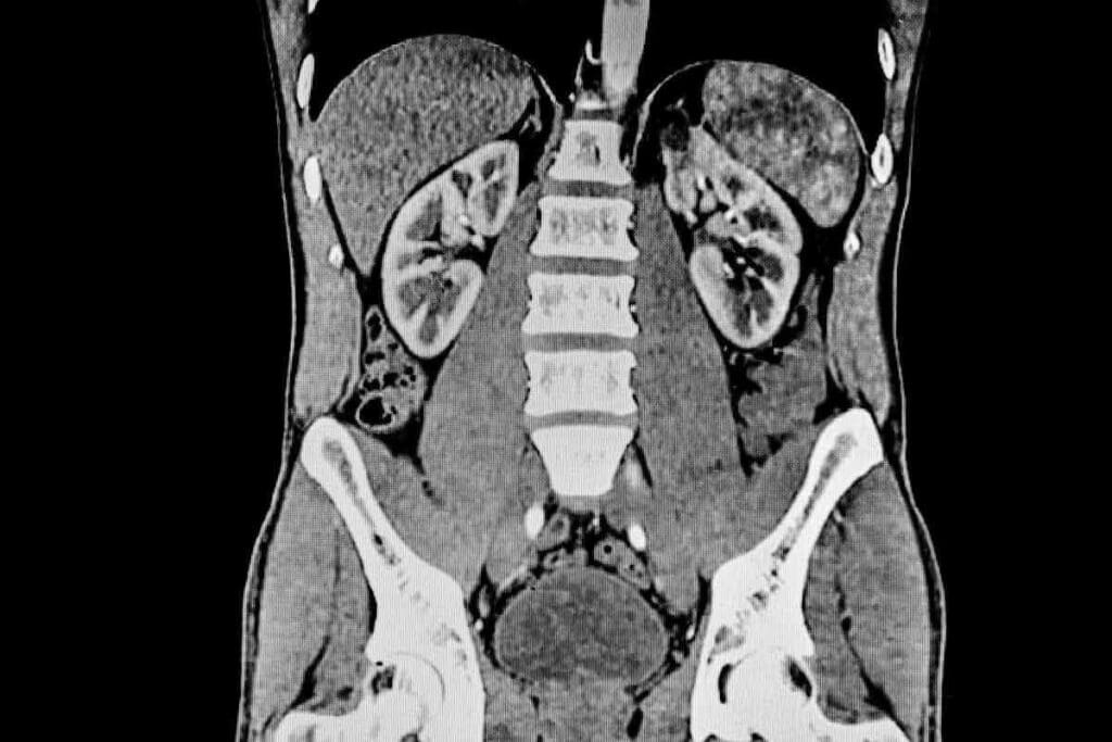 Prep for Kidney CT Scan: The Ultimate Amazing Guide