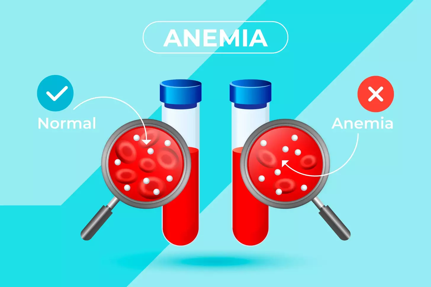 7 Essential Facts About Aplastic Anemia and the Aplastic Anemia & MDS International Foundation