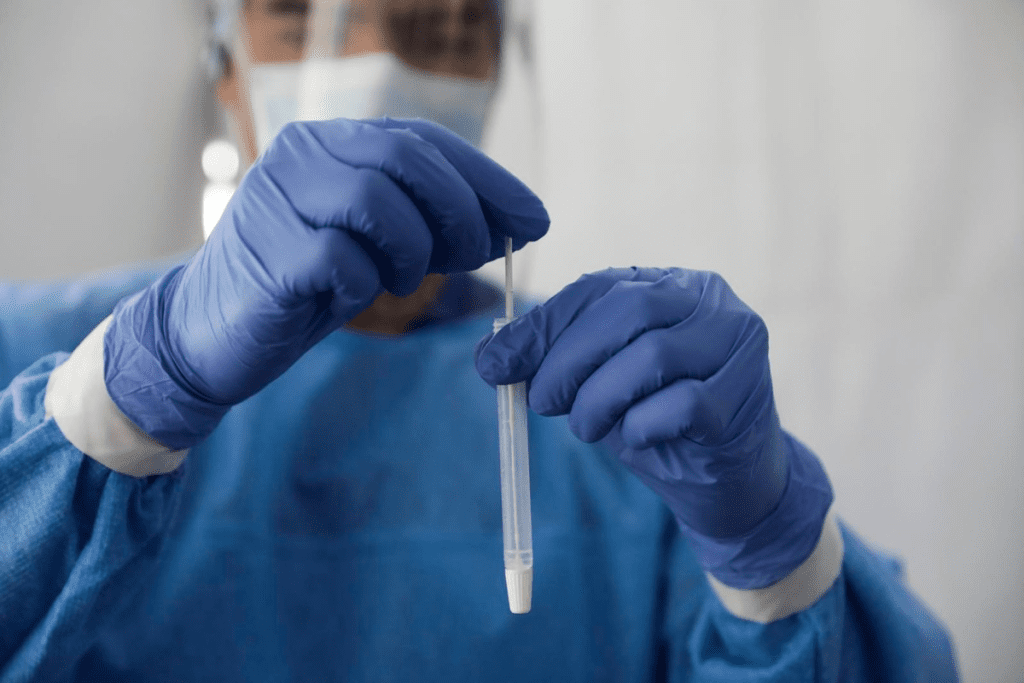 Test for Lupus: CBC and Auto Diff with Reflex