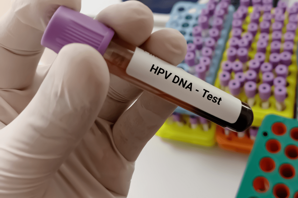 High Hematocrit: The Critical Dangers Unveiled