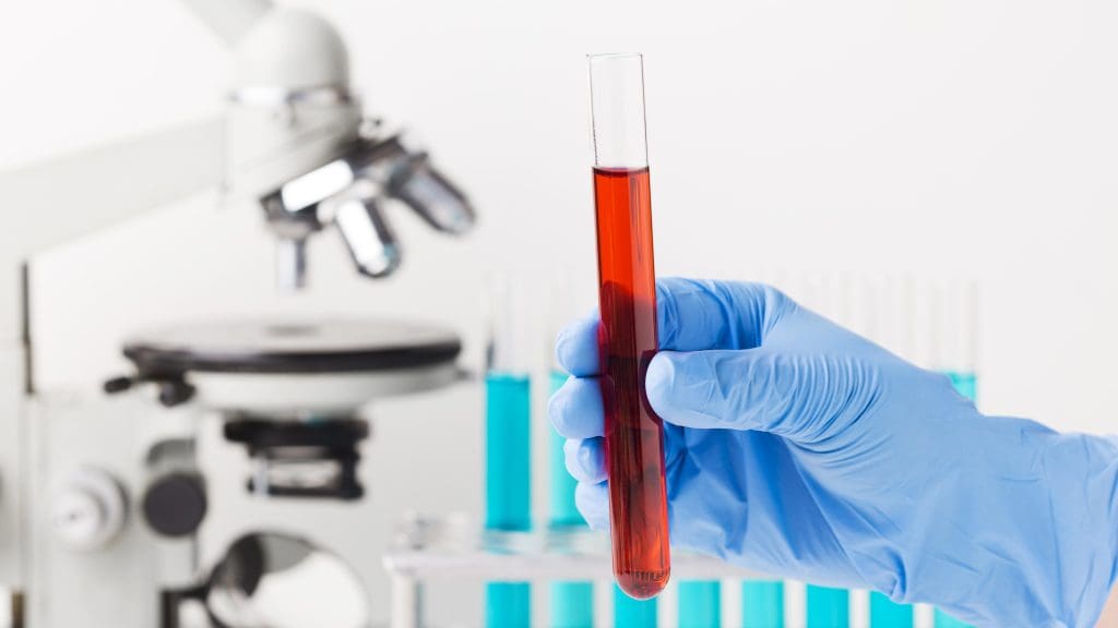 What Causes Blood to Thin