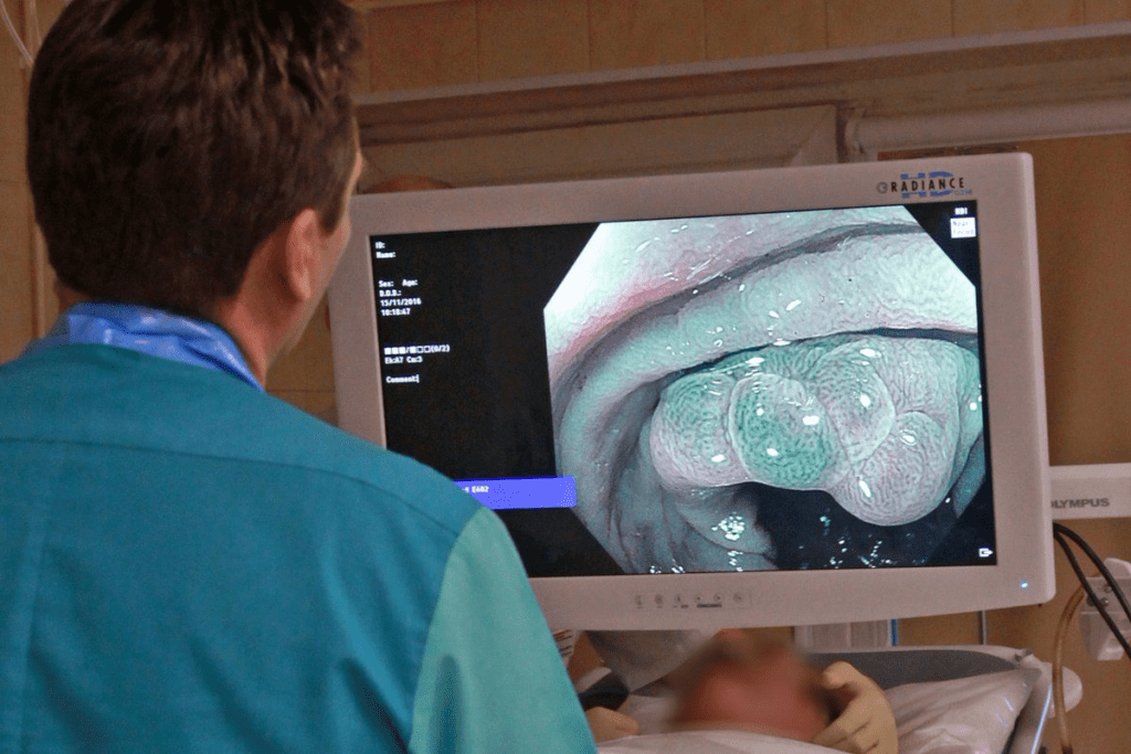 Colonoscopy vs. Prostate Exam Procedure 1 Colonoscopy vs. prostate exam procedure