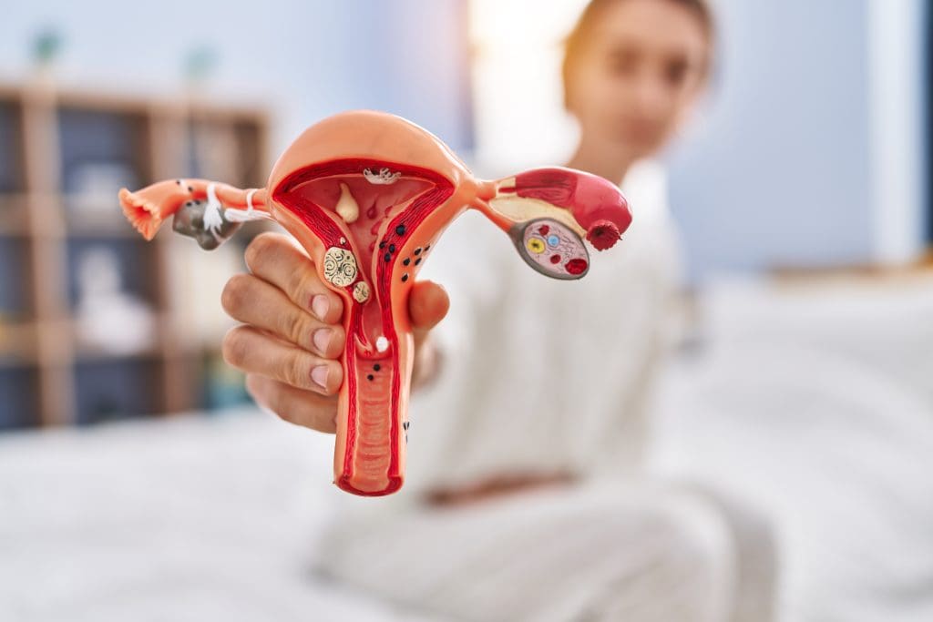 commonly mistaken for ovarian cancer