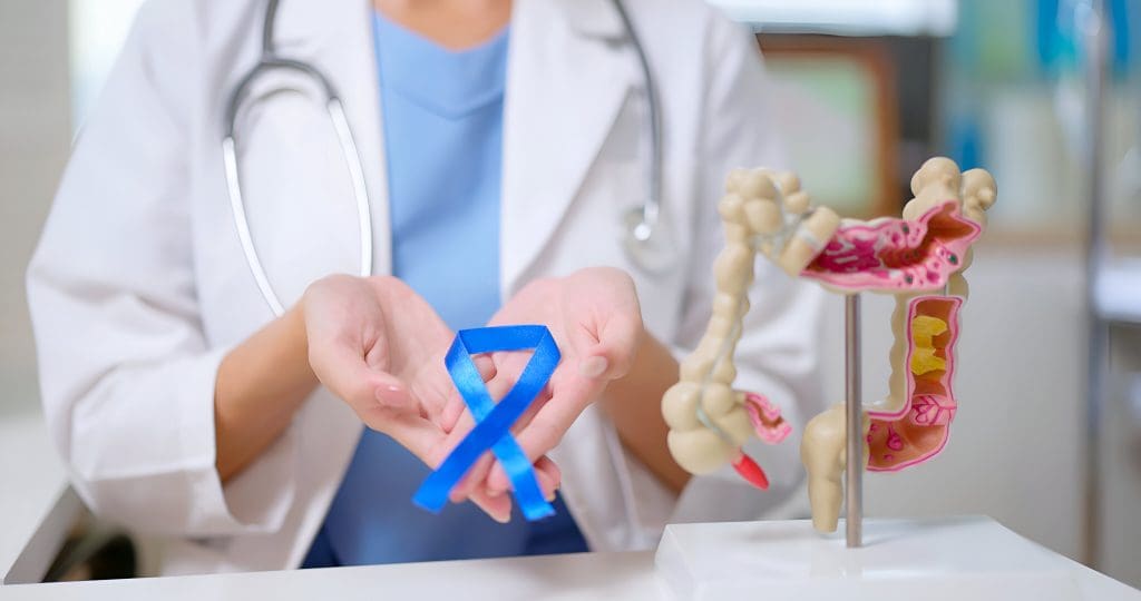 How to check at home if you have colon cancer