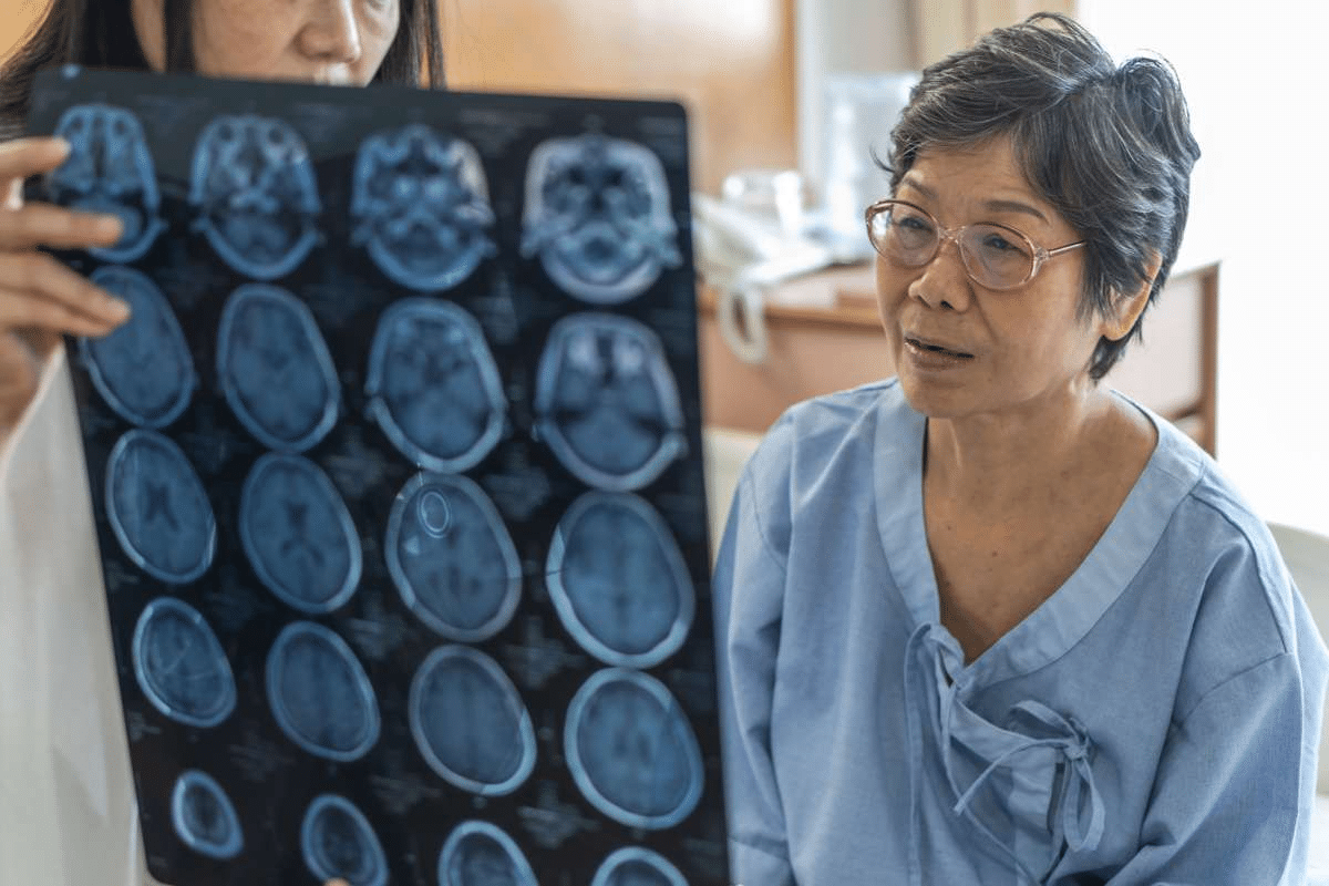 Amyloid Brain Disease: Best Care Guide