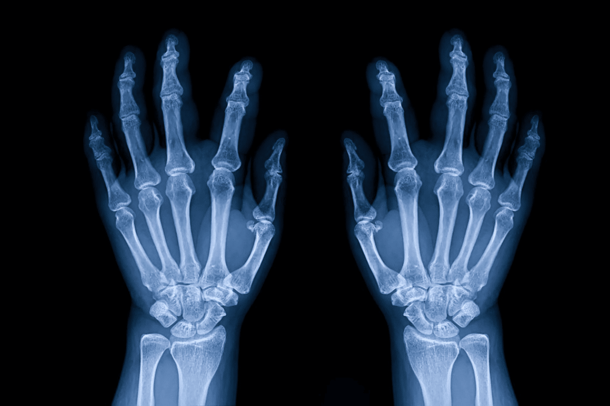 Best Calcium Supplement: Top Safe Picks