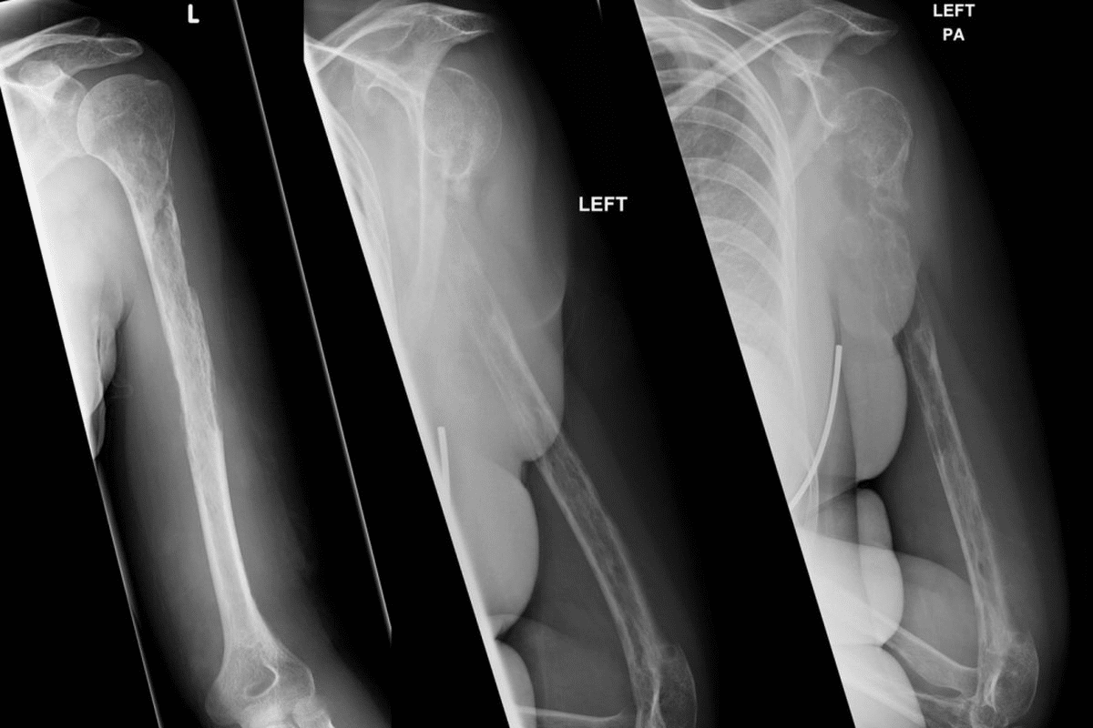 word image 254440 2 LIV Hospital