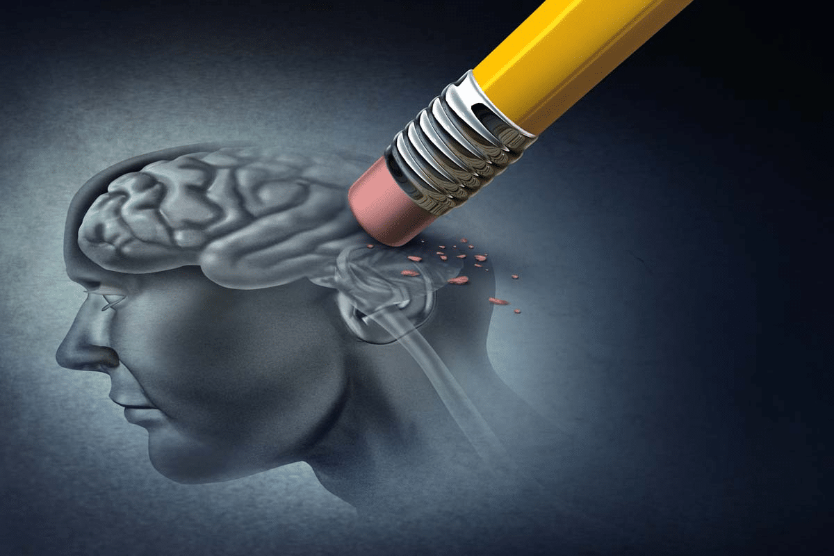 Anti Amyloid Treatment: Does It Really Work?