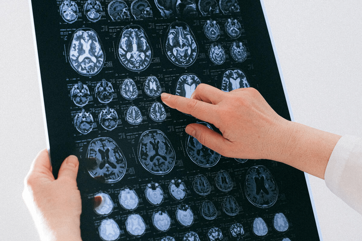 How Can You Tell If You Have Brain Damage?