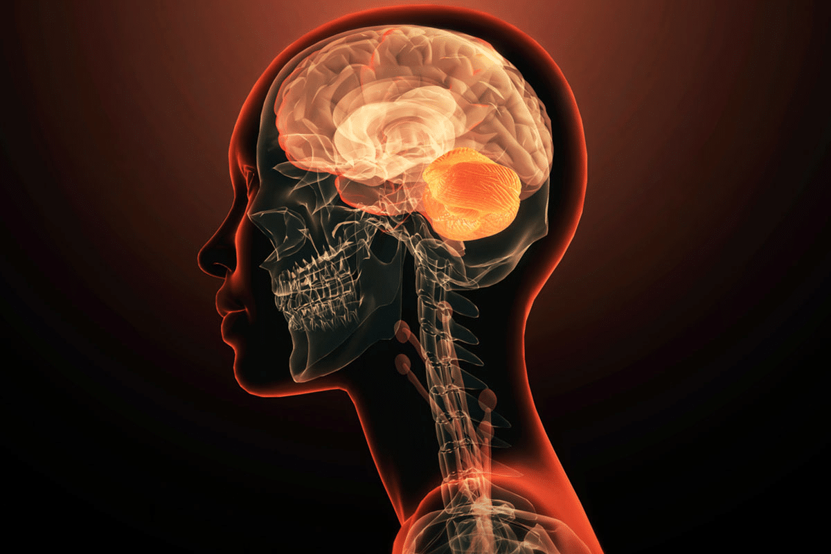 Have I Got Brain Damage? Best Check