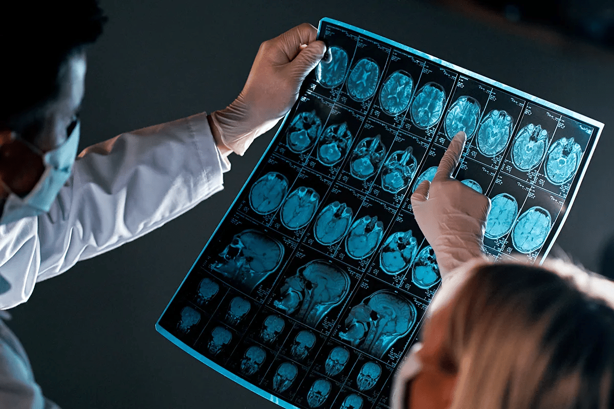 Plaques and Tangles: Best Brain Guide