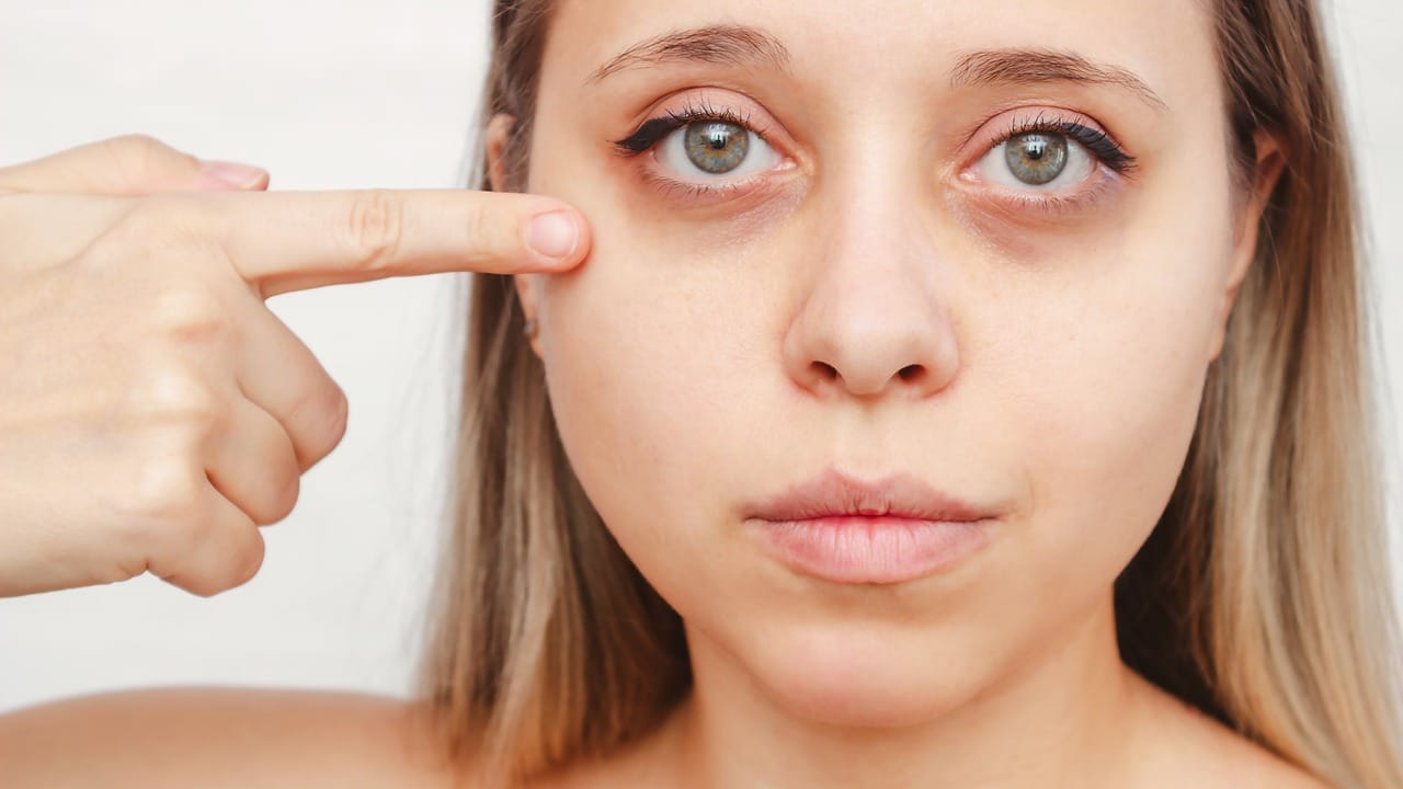 Autoimmune Eye Diseases