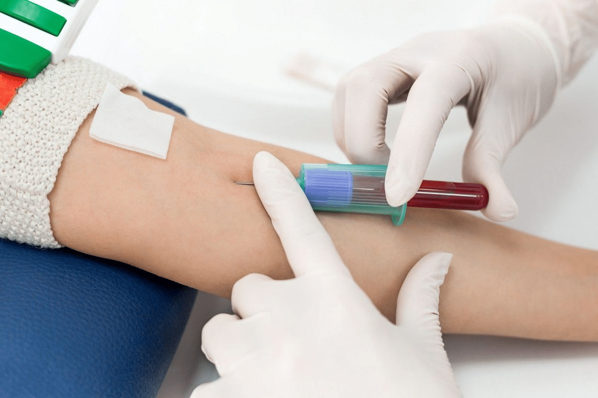Key What Blood Tests For Autoimmune Diseases Are Used?