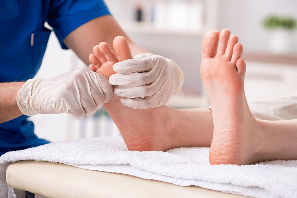Complete How To Treat Vein On Top Of Foot Hurts
