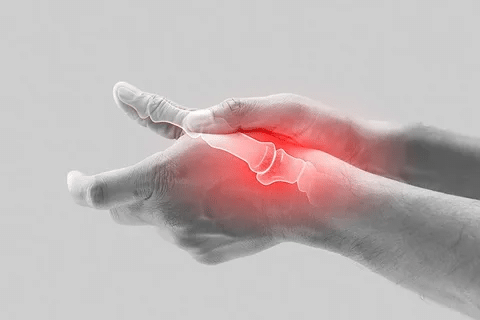 Complete Does Arthritis Cause Muscle Pain And Aches?