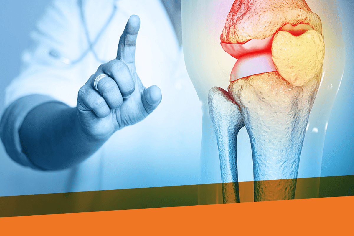 Fascinating How To Use IV Treatment For Bone Loss Effectively