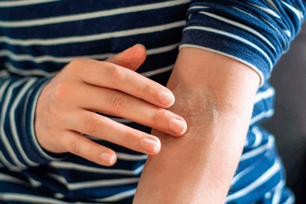 Amazing Autoimmune Rash On Arms: Which Diseases?