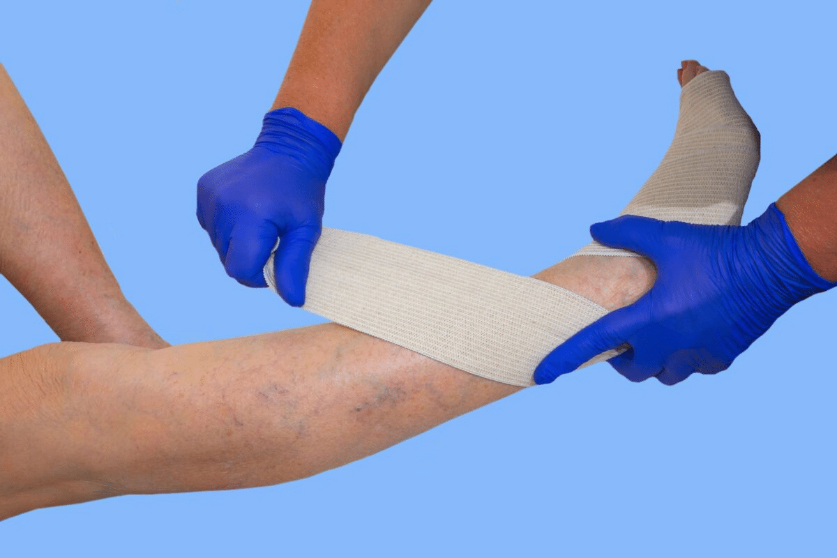 Essential Hard Vein After IV Treatment: When To Worry?