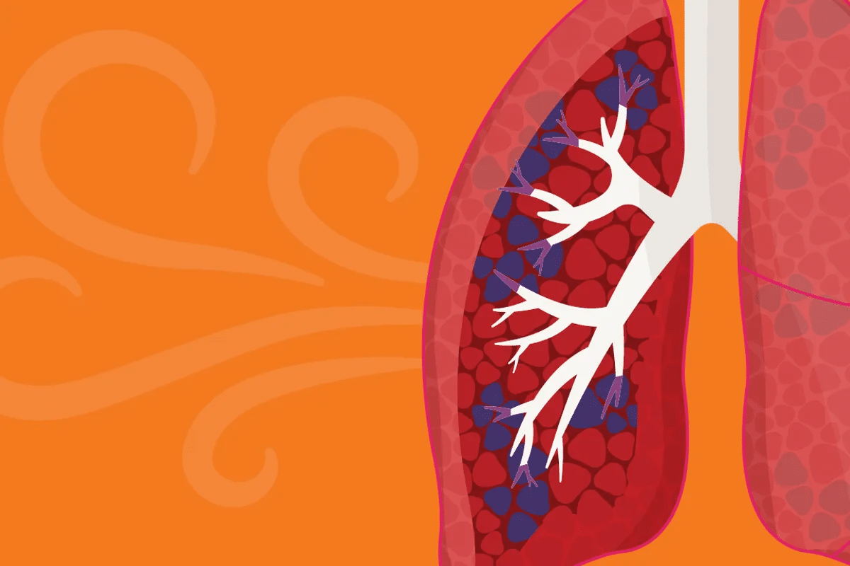 word image 240261 2 LIV Hospital