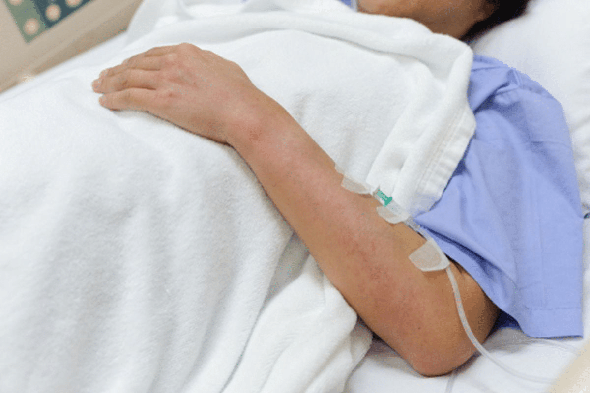 Insightful Complete Guide To Autoimmune Hives Treatment